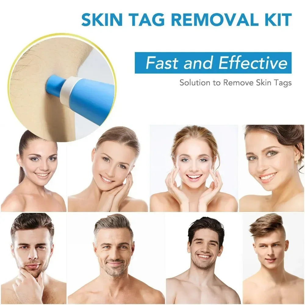 2-in-1 Automatic Skin Tag Removal Pen Kit