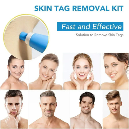2-in-1 Automatic Skin Tag Removal Pen Kit